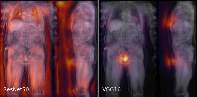 Figure 4 for Deep regression for uncertainty-aware and interpretable analysis of large-scale body MRI