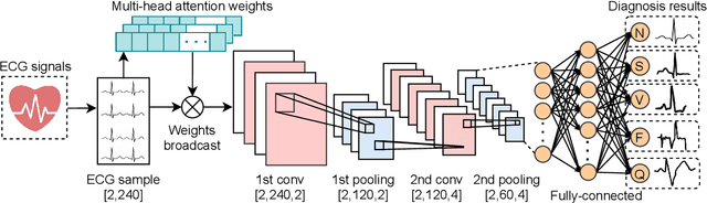 Figure 1 for ECG-Based Heart Arrhythmia Diagnosis Through Attentional Convolutional Neural Networks