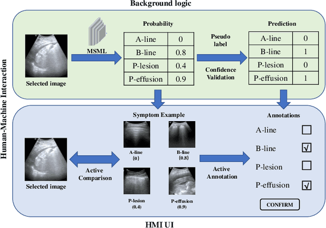 Figure 4 for Semi-Supervised Active Learning for COVID-19 Lung Ultrasound Multi-symptom Classification
