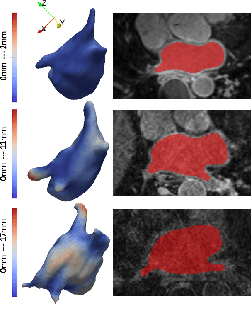Figure 4 for Deep Learning for End-to-End Atrial Fibrillation Recurrence Estimation