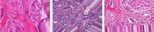 Figure 1 for Breast Cancer Detection using Histopathological Images