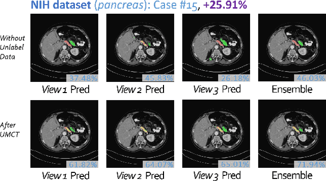 Figure 3 for 3D Semi-Supervised Learning with Uncertainty-Aware Multi-View Co-Training