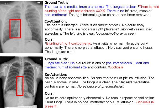 Figure 1 for Competence-based Multimodal Curriculum Learning for Medical Report Generation