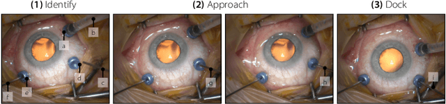 Figure 1 for ColibriDoc: An Eye-in-Hand Autonomous Trocar Docking System