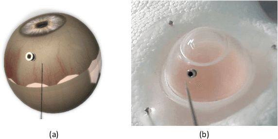 Figure 3 for ColibriDoc: An Eye-in-Hand Autonomous Trocar Docking System