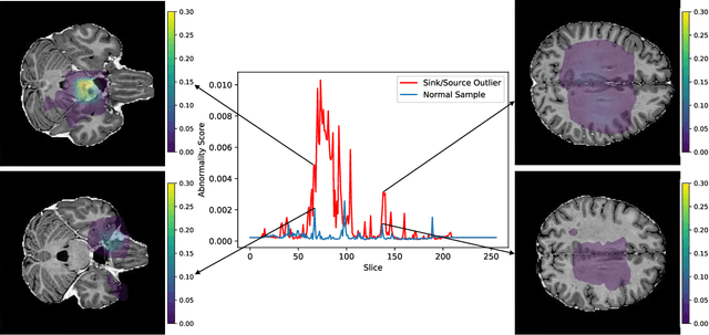 Figure 4 for Detecting Outliers with Foreign Patch Interpolation