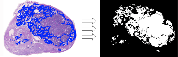 Figure 1 for Improving Prostate Cancer Detection with Breast Histopathology Images