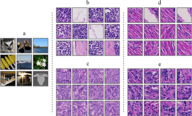 Figure 3 for Improving Prostate Cancer Detection with Breast Histopathology Images