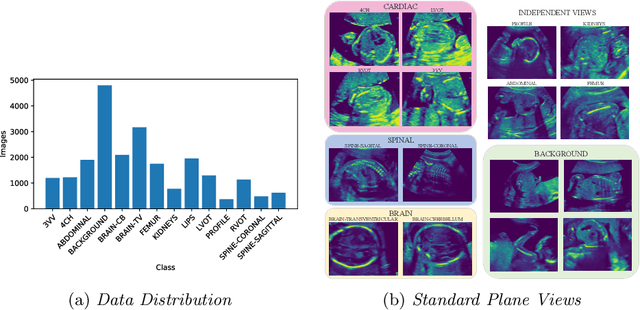 Figure 1 for Semi-supervised Learning of Fetal Anatomy from Ultrasound