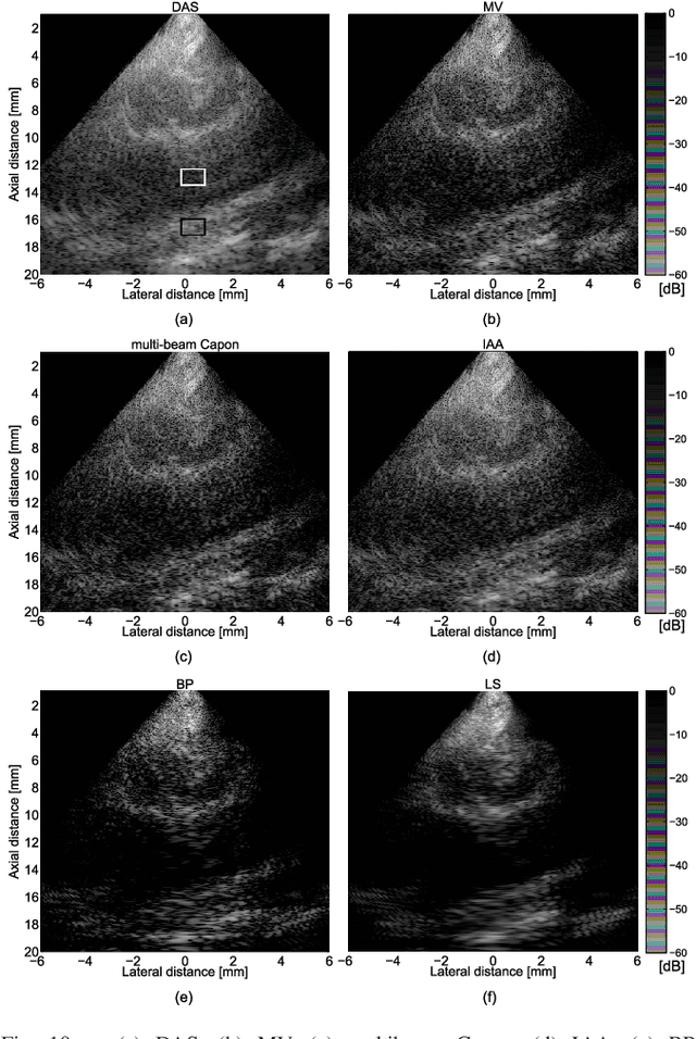 Figure 2 for Beamforming through regularized inverse problems in ultrasound medical imaging