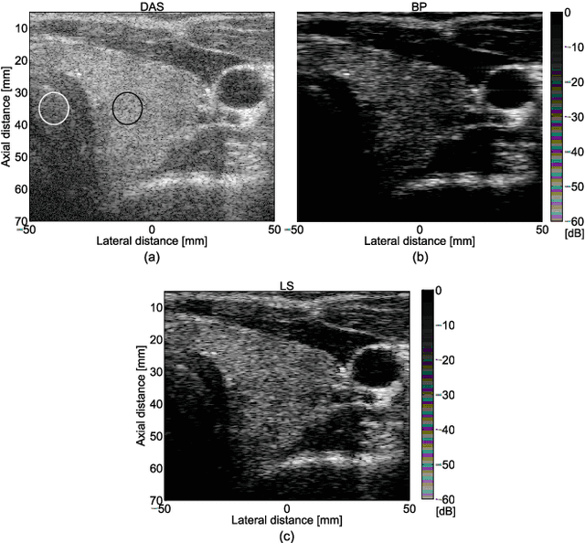Figure 3 for Beamforming through regularized inverse problems in ultrasound medical imaging