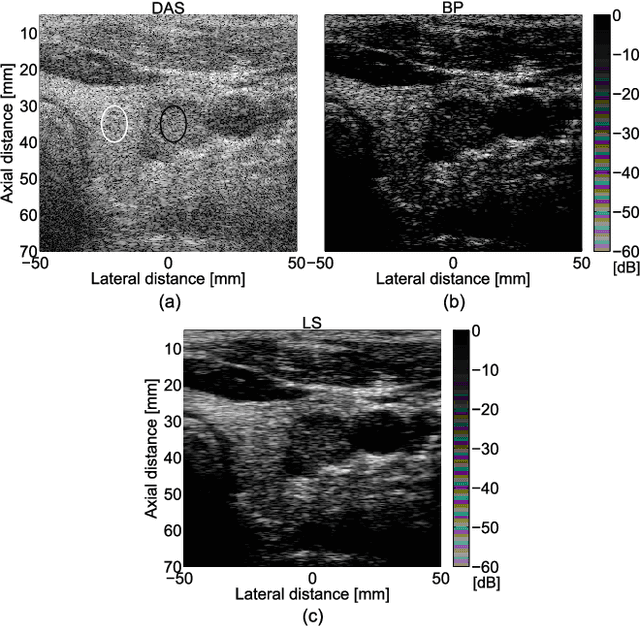 Figure 4 for Beamforming through regularized inverse problems in ultrasound medical imaging