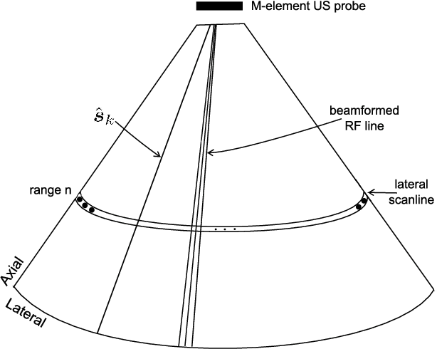 Figure 1 for Beamforming through regularized inverse problems in ultrasound medical imaging