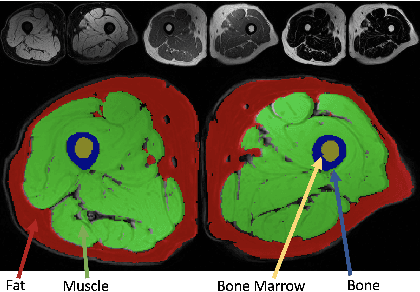Figure 1 for Multi-Contrast MRI Segmentation Trained on Synthetic Images