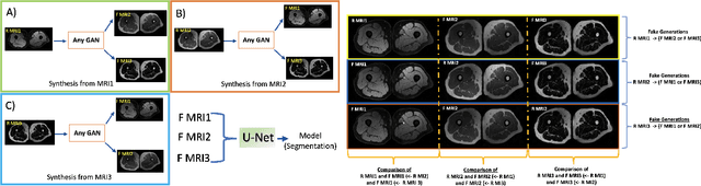 Figure 2 for Multi-Contrast MRI Segmentation Trained on Synthetic Images