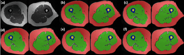 Figure 3 for Multi-Contrast MRI Segmentation Trained on Synthetic Images