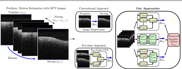 Figure 1 for Spatio-Temporal Deep Learning Methods for Motion Estimation Using 4D OCT Image Data