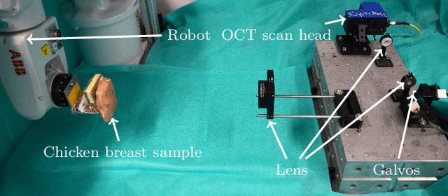 Figure 3 for Spatio-Temporal Deep Learning Methods for Motion Estimation Using 4D OCT Image Data
