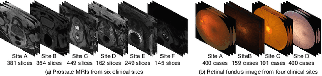 Figure 3 for Single-domain Generalization in Medical Image Segmentation via Test-time Adaptation from Shape Dictionary