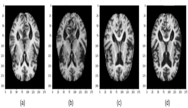 Figure 1 for Detection of Alzheimer's Disease Using Graph-Regularized Convolutional Neural Network Based on Structural Similarity Learning of Brain Magnetic Resonance Images