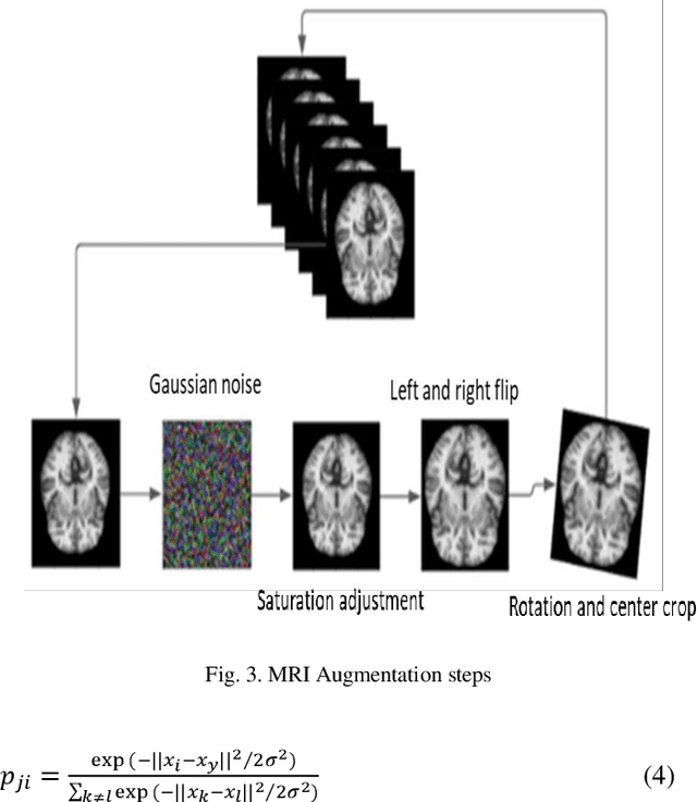 Figure 2 for Detection of Alzheimer's Disease Using Graph-Regularized Convolutional Neural Network Based on Structural Similarity Learning of Brain Magnetic Resonance Images
