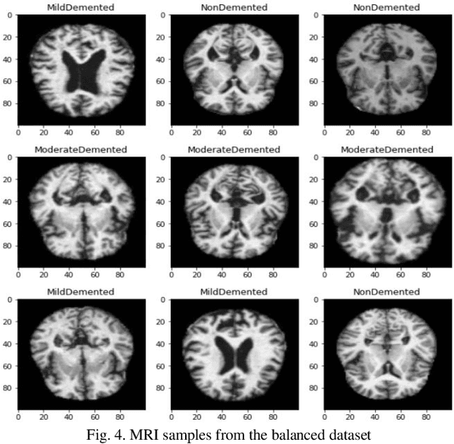 Figure 3 for Detection of Alzheimer's Disease Using Graph-Regularized Convolutional Neural Network Based on Structural Similarity Learning of Brain Magnetic Resonance Images