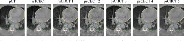 Figure 3 for Multitask 3D CBCT-to-CT Translation and Organs-at-Risk Segmentation Using Physics-Based Data Augmentation