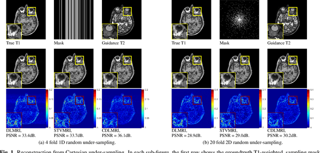 Figure 1 for Coupled Dictionary Learning for Multi-contrast MRI Reconstruction