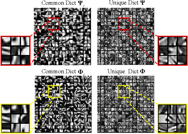 Figure 2 for Coupled Dictionary Learning for Multi-contrast MRI Reconstruction