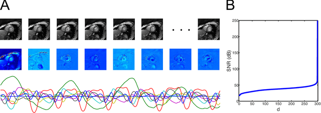 Figure 1 for Video Compressive Sensing for Dynamic MRI