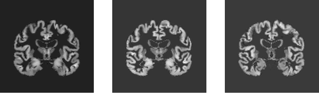 Figure 1 for Learning Shape Features and Abstractions in 3D Convolutional Neural Networks for Detecting Alzheimer's Disease