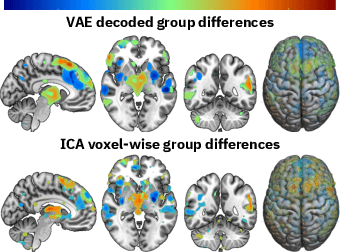 Figure 3 for Fusing multimodal neuroimaging data with a variational autoencoder