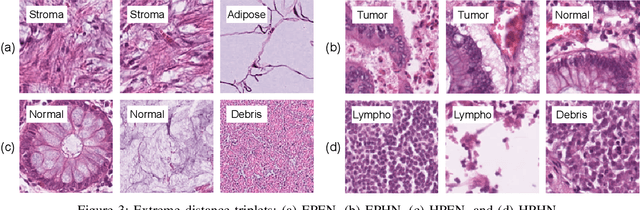 Figure 3 for Offline versus Online Triplet Mining based on Extreme Distances of Histopathology Patches