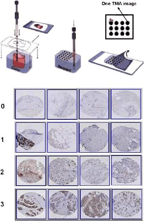 Figure 1 for Statistical methods for tissue array images - algorithmic scoring and co-training