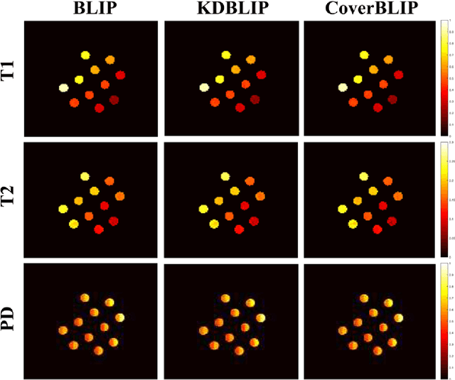 Figure 4 for CoverBLIP: scalable iterative matched filtering for MR Fingerprint recovery