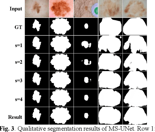 Figure 4 for A Multi-stage Framework with Context Information Fusion Structure for Skin Lesion Segmentation