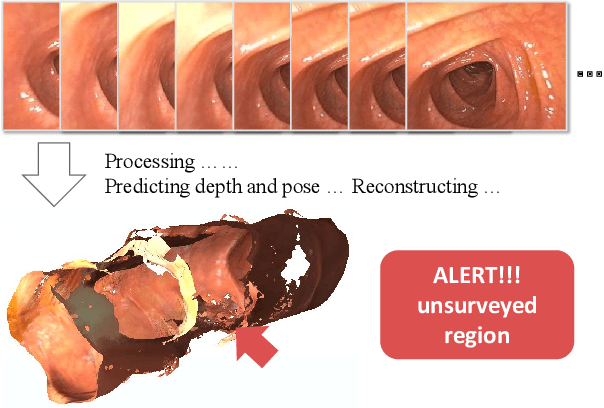 Figure 1 for ColDE: A Depth Estimation Framework for Colonoscopy Reconstruction