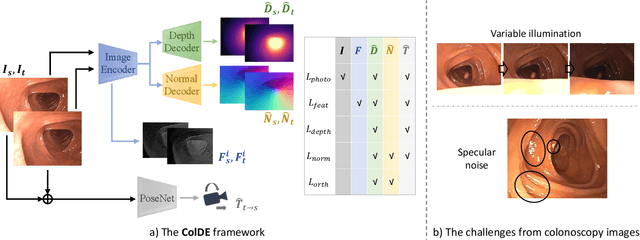 Figure 3 for ColDE: A Depth Estimation Framework for Colonoscopy Reconstruction