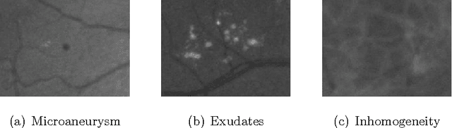 Figure 3 for An ensemble-based system for automatic screening of diabetic retinopathy