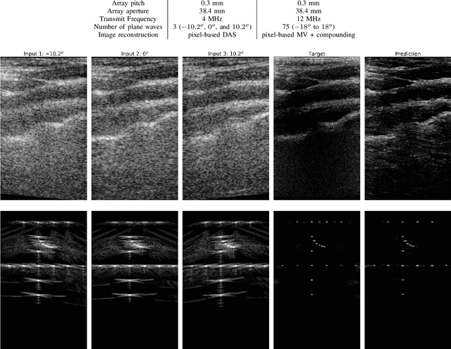 Figure 3 for Deep Proximal Learning for High-Resolution Plane Wave Compounding