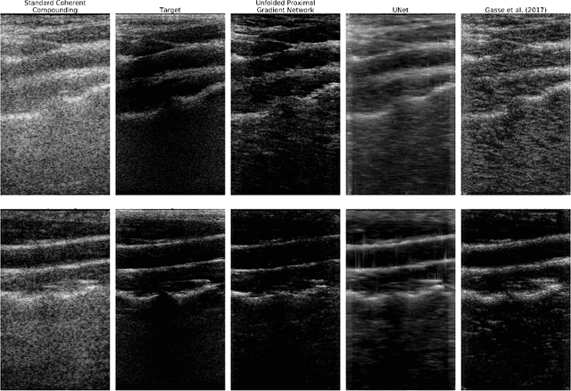 Figure 4 for Deep Proximal Learning for High-Resolution Plane Wave Compounding