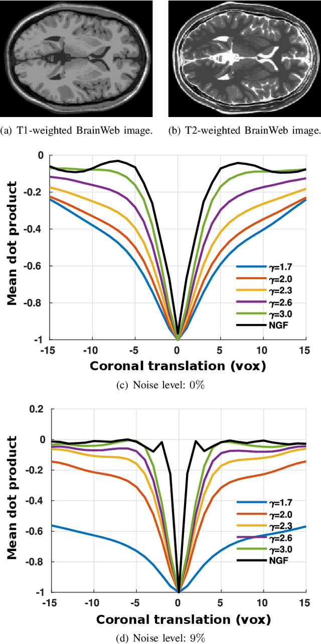 Figure 2 for Regularized directional representations for medical image registration