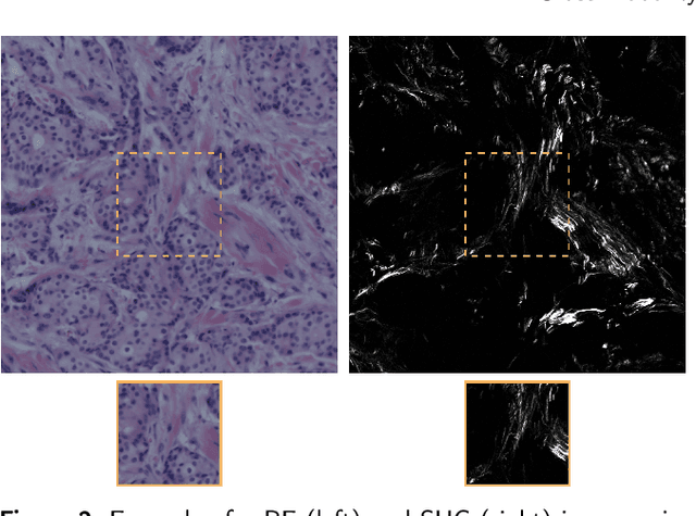 Figure 3 for Cross-Modality Sub-Image Retrieval using Contrastive Multimodal Image Representations