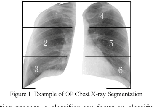 Figure 1 for Incoporating Weighted Board Learning System for Accurate Occupational Pneumoconiosis Staging