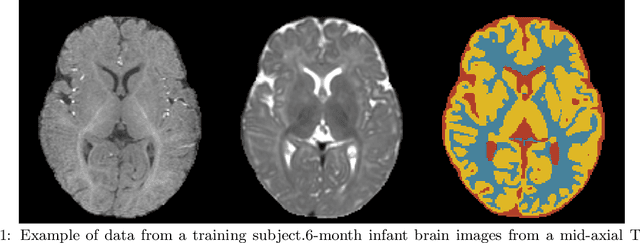 Figure 1 for Deep CNN ensembles and suggestive annotations for infant brain MRI segmentation