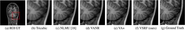 Figure 4 for Learning from a Handful Volumes: MRI Resolution Enhancement with Volumetric Super-Resolution Forests