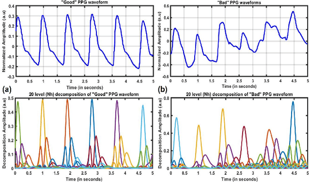 Figure 3 for Signal Quality Assessment of Photoplethysmogram Signals using Quantum Pattern Recognition and lightweight CNN Architecture