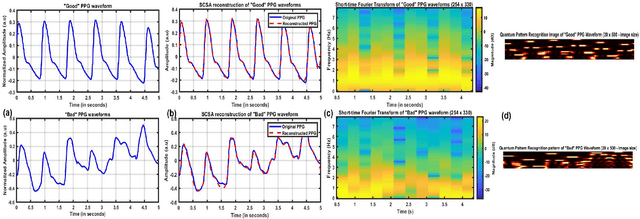 Figure 4 for Signal Quality Assessment of Photoplethysmogram Signals using Quantum Pattern Recognition and lightweight CNN Architecture