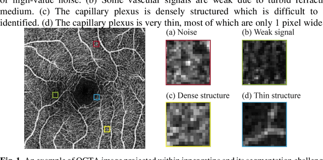 Figure 1 for Image Magnification Network for Vessel Segmentation in OCTA Images