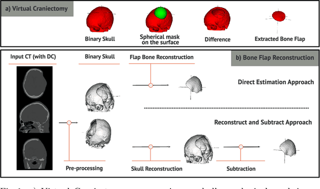 Figure 1 for Self-supervised Skull Reconstruction in Brain CT Images with Decompressive Craniectomy